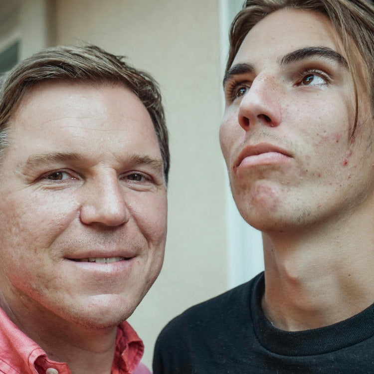 Ein junger Mann mit Akne und ein erwachsener Mann mit Akne
